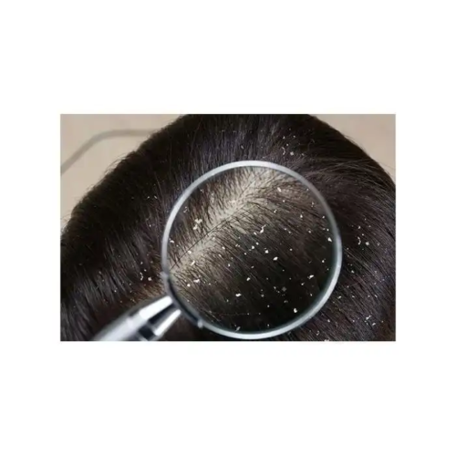 Alternative view of Caspiselen KIN Anti-Dandruff Shampoo – 200ml