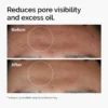 The Ordinary Niacinamide 10% + Zinc 1% Serum - Thumbnail Image 2
