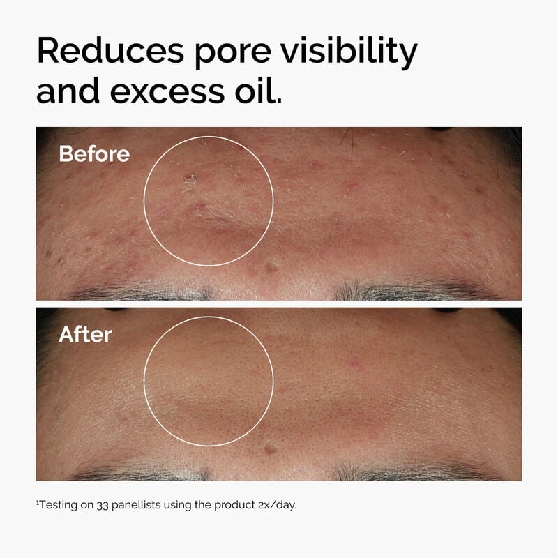The Ordinary Niacinamide 10% + Zinc 1% Serum - Image 2